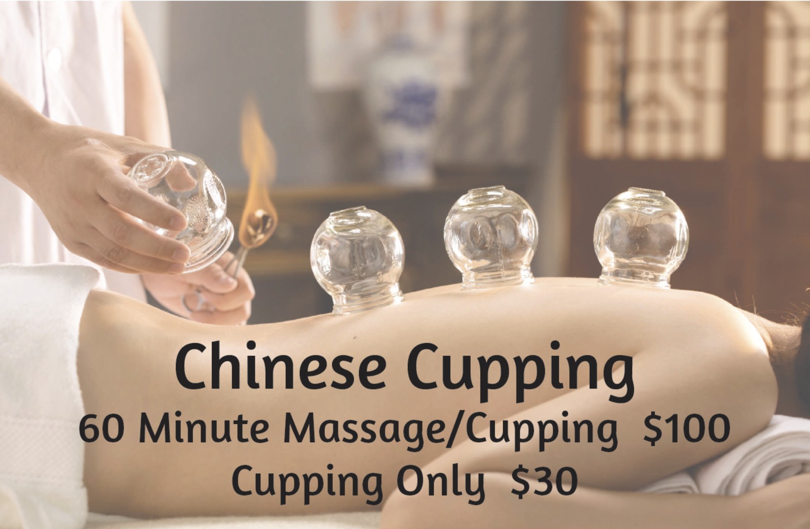 Chinese cupping service pricing at Five Points Massage